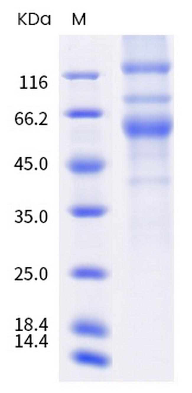 SARS-CoV-2 Spike Protein S1/S2 (mutant) His-tag Protein