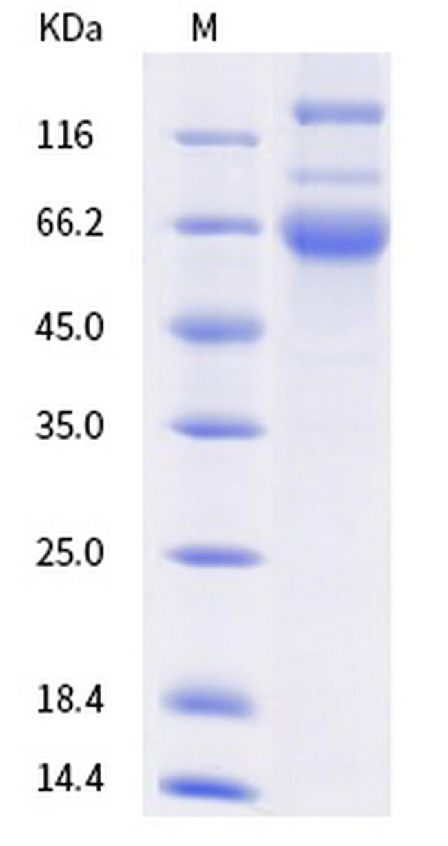 SARS-CoV-2 Spike Protein S1/S2 (AY.2) His-tag Protein