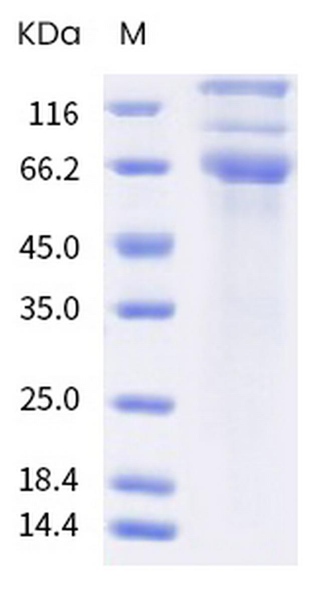 SARS-CoV-2 Spike Protein S1/S2 (B.1.617.1) His-tag Protein