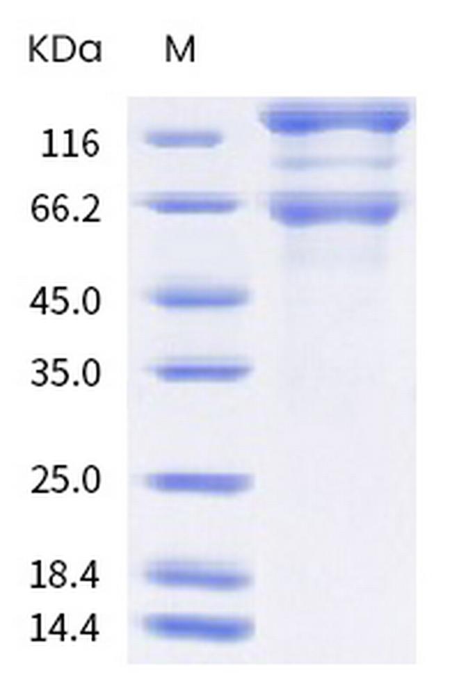 SARS-CoV-2 Spike Protein S1/S2 (B.1.618) His-tag Protein