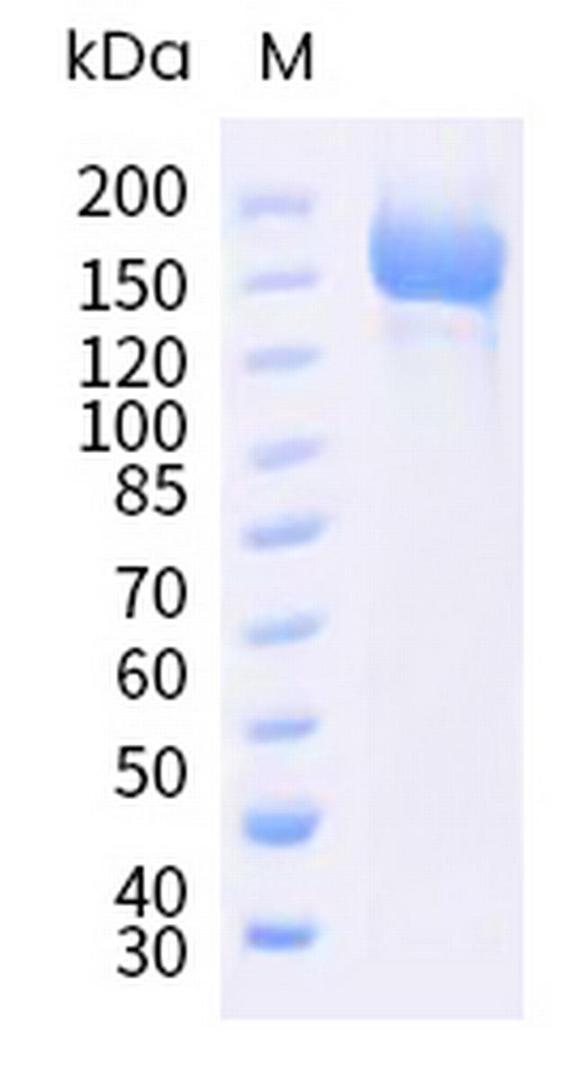 SARS-CoV-2 Spike Protein S1/S2 (BA.4) His-tag, trimer Protein