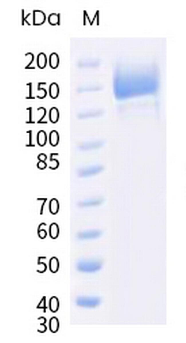 SARS-CoV-2 Spike Protein S1/S2 (BA.5) His-tag Protein