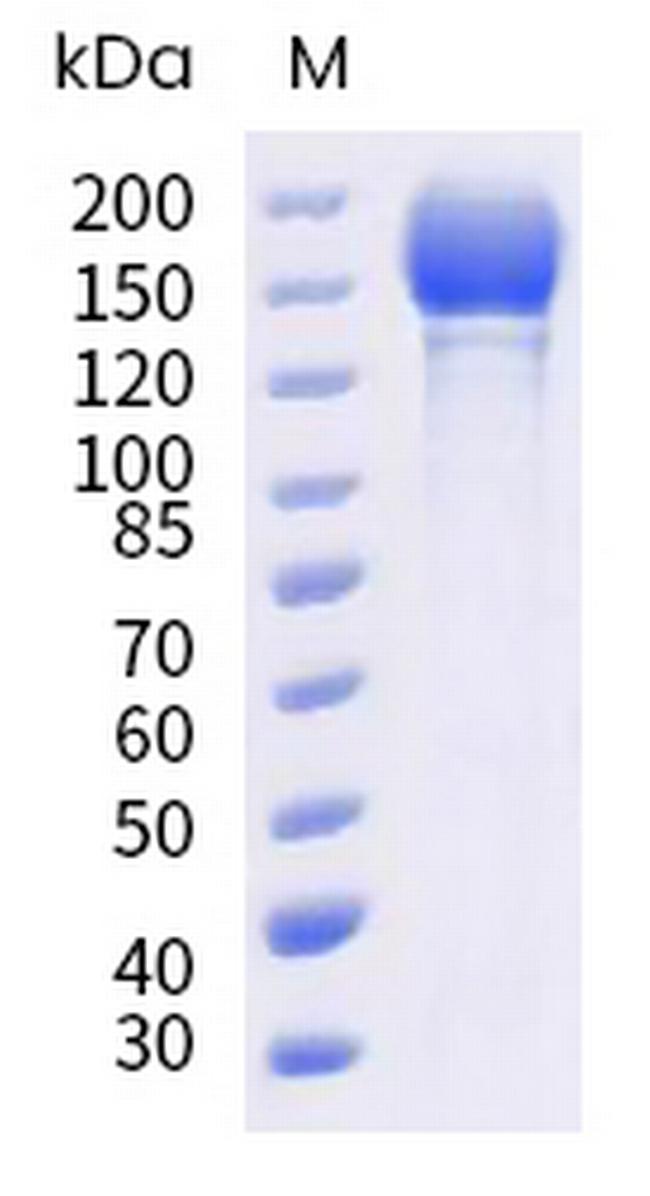 SARS-CoV-2 Spike Protein S1/S2 (BA.2.12.1) His-tag, trimer Protein