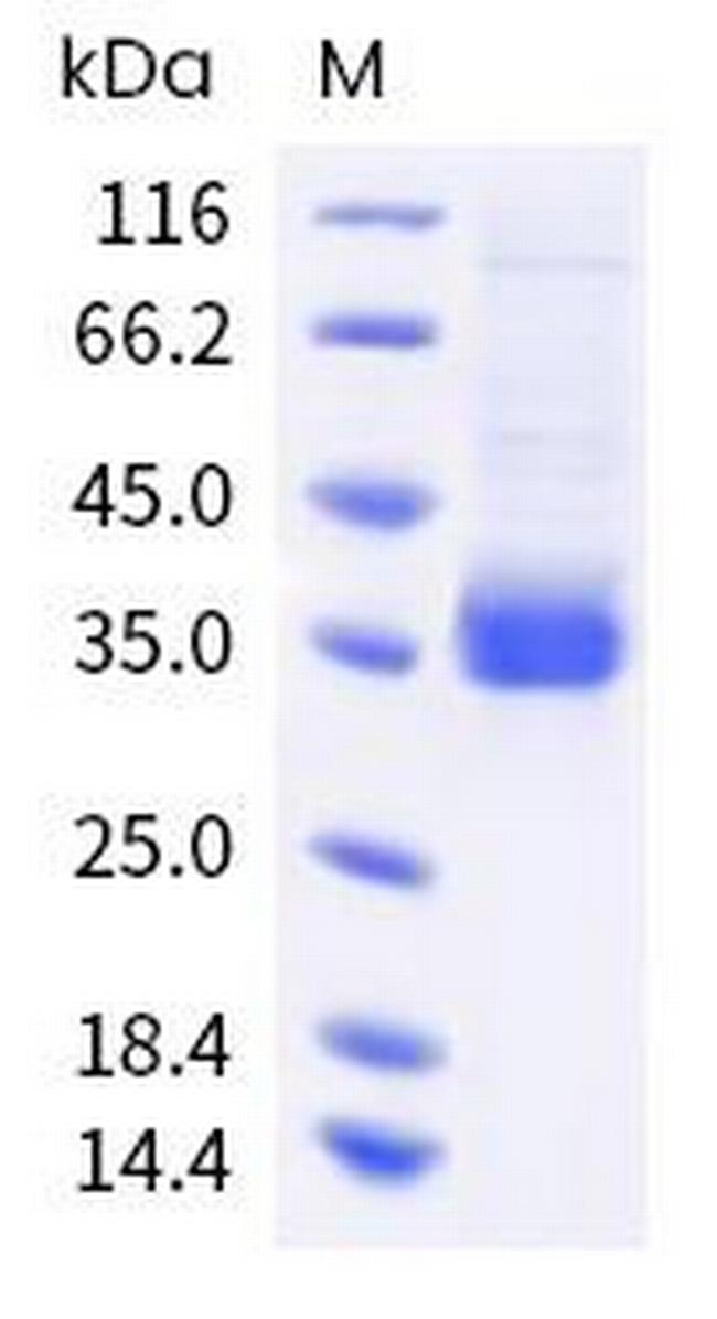 SARS-CoV-2 Spike Protein (RBD) (BA.2.9.1; BA.2.13) His-tag Protein