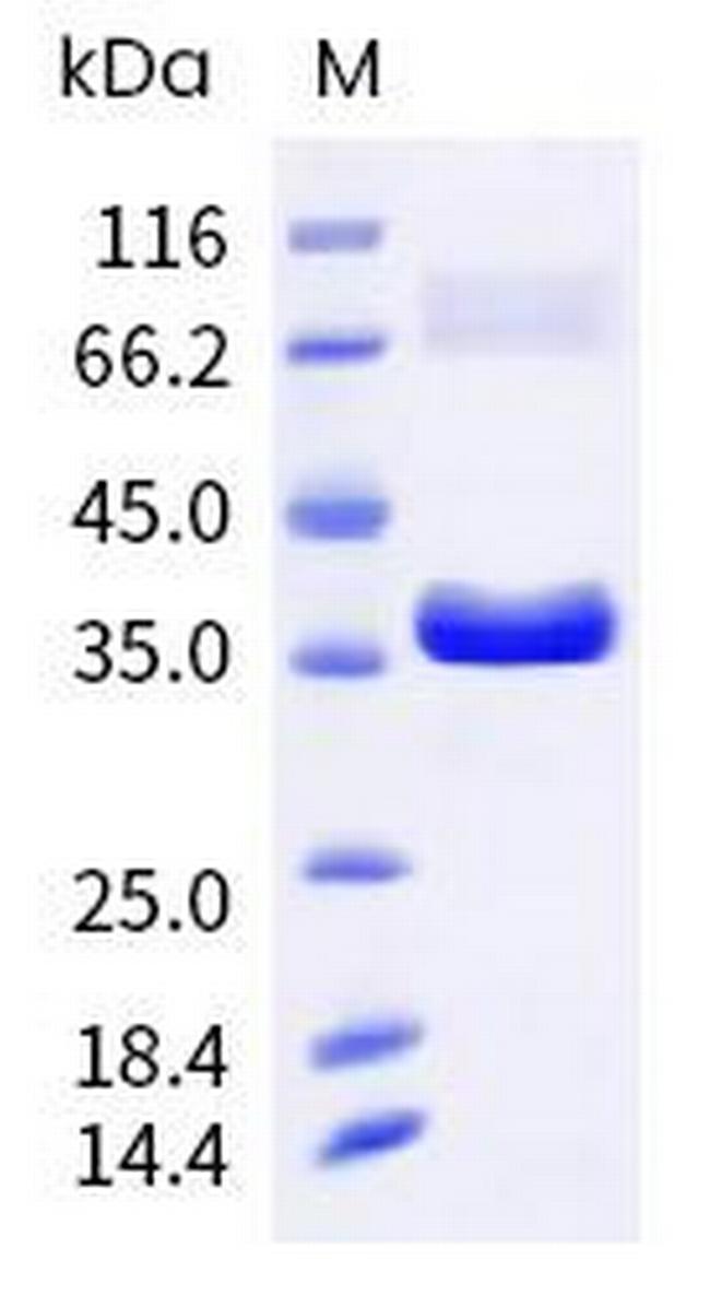 Monkeypox Virus I1L His-tag Protein