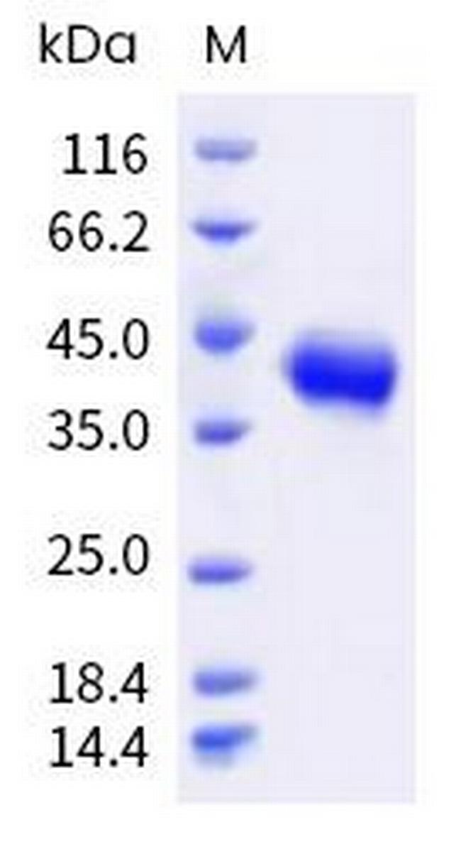 Monkeypox Virus H3 Envelope His-tag Protein