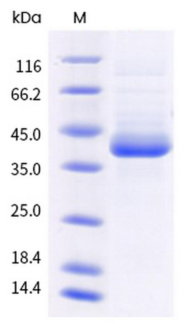 Monkeypox Virus B6R His-tag Protein
