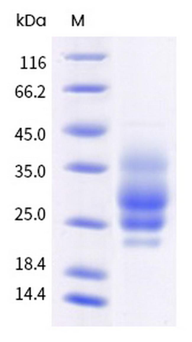 Monkeypox Virus M1R His-tag Protein