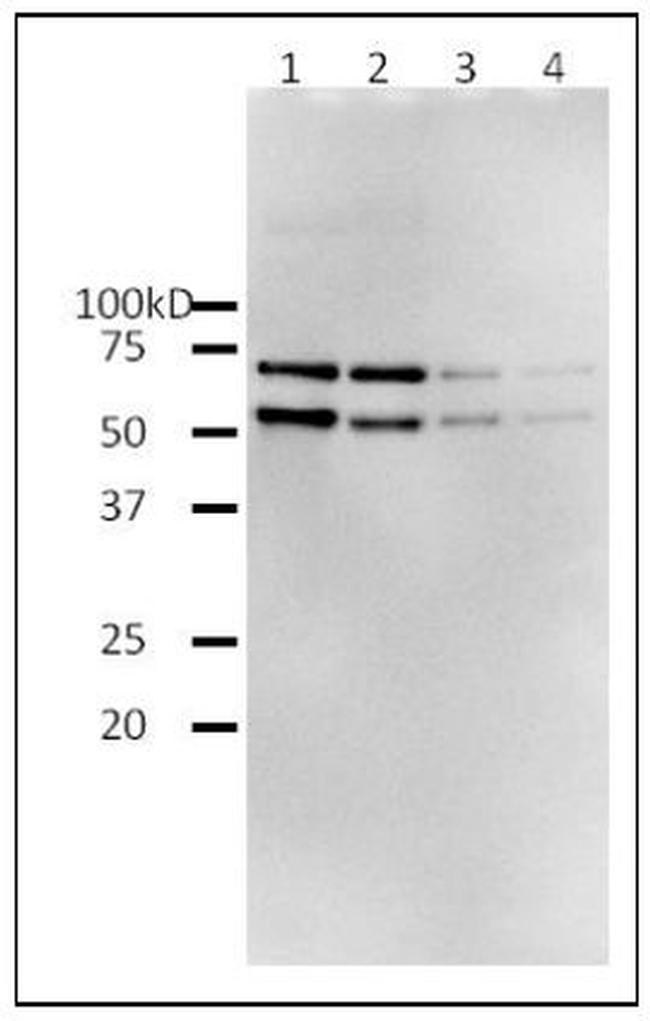 HIV1 Reverse Transcriptase Protein in Western blot control (WB Ctrl)