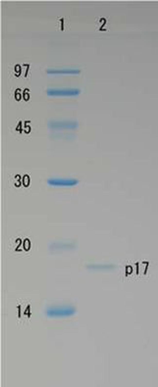 HIV1 p17 Protein in Western blot control (WB Ctrl)