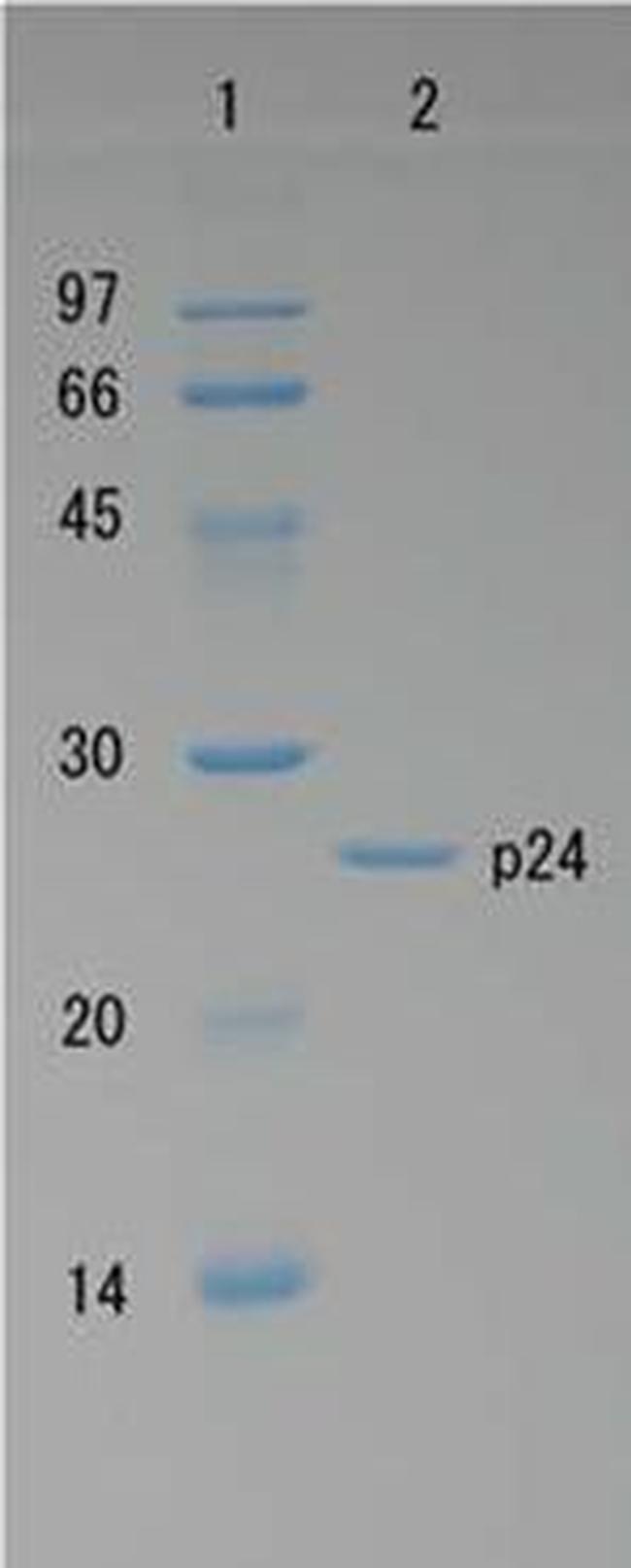HIV1 p24 Protein in Western blot control (WB Ctrl)