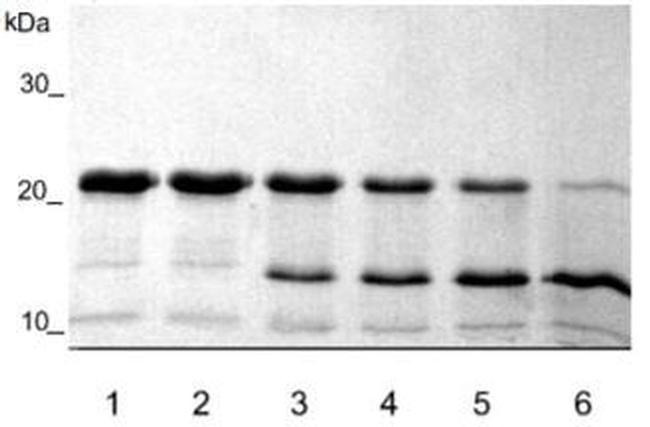 Human Aggrecan (Interglobular Domain) Protein