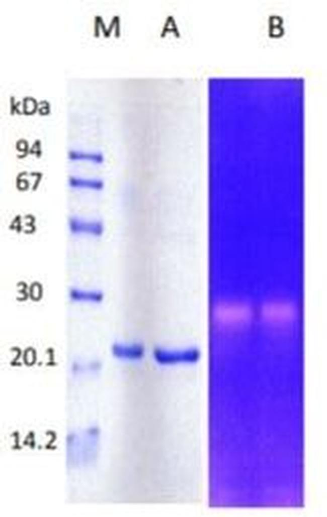 Human MMP-3 Protein