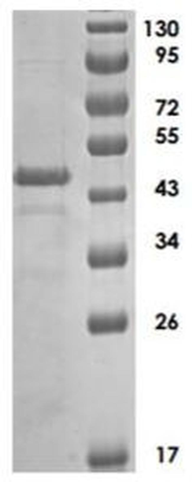 Human ADAMTS5 Protein