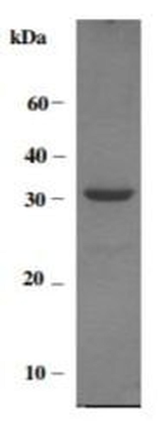 Human MMP-14 (Prodomain-catalytic Domain) Protein