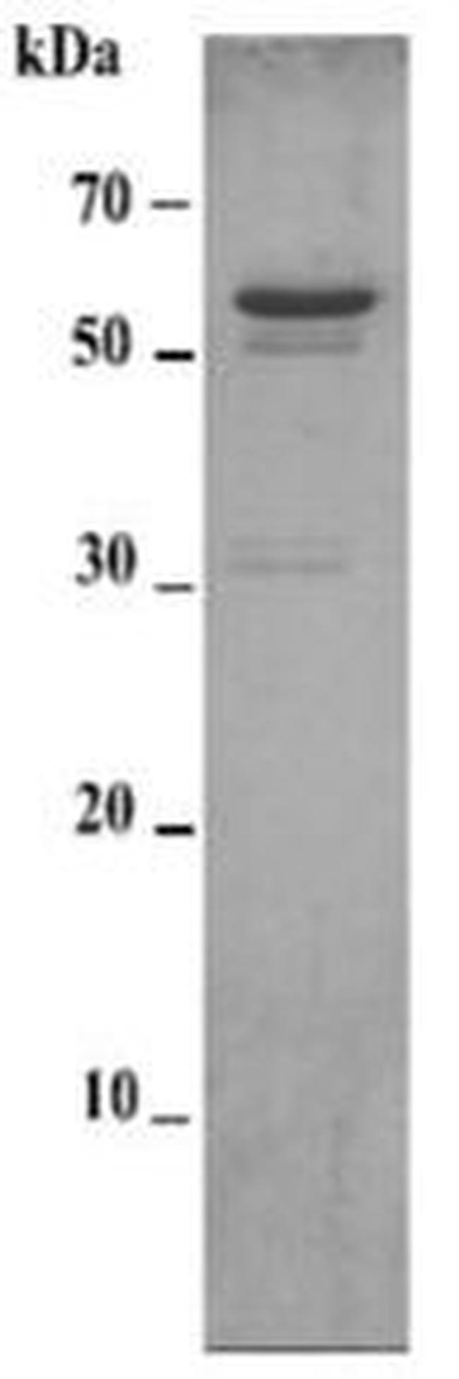 Human MMP-14 (Prodomain-catalytic domain-hemopexin domain) His-tag Protein