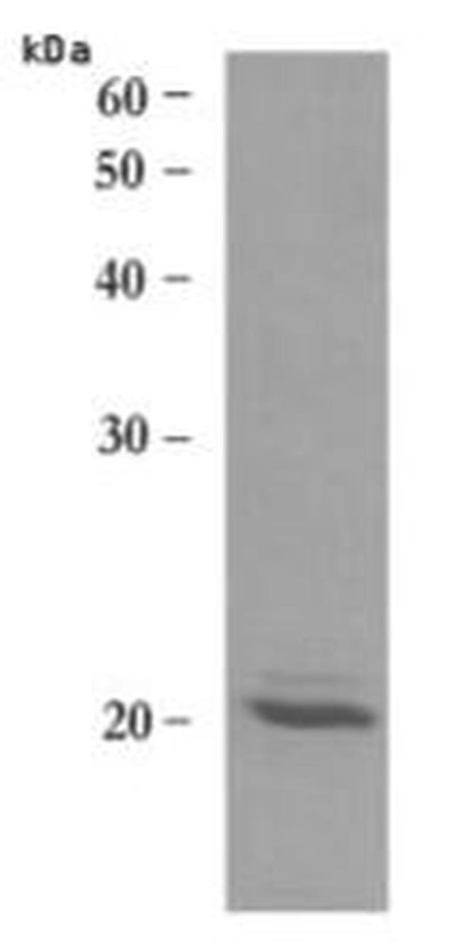 Human MMP-15 Protein