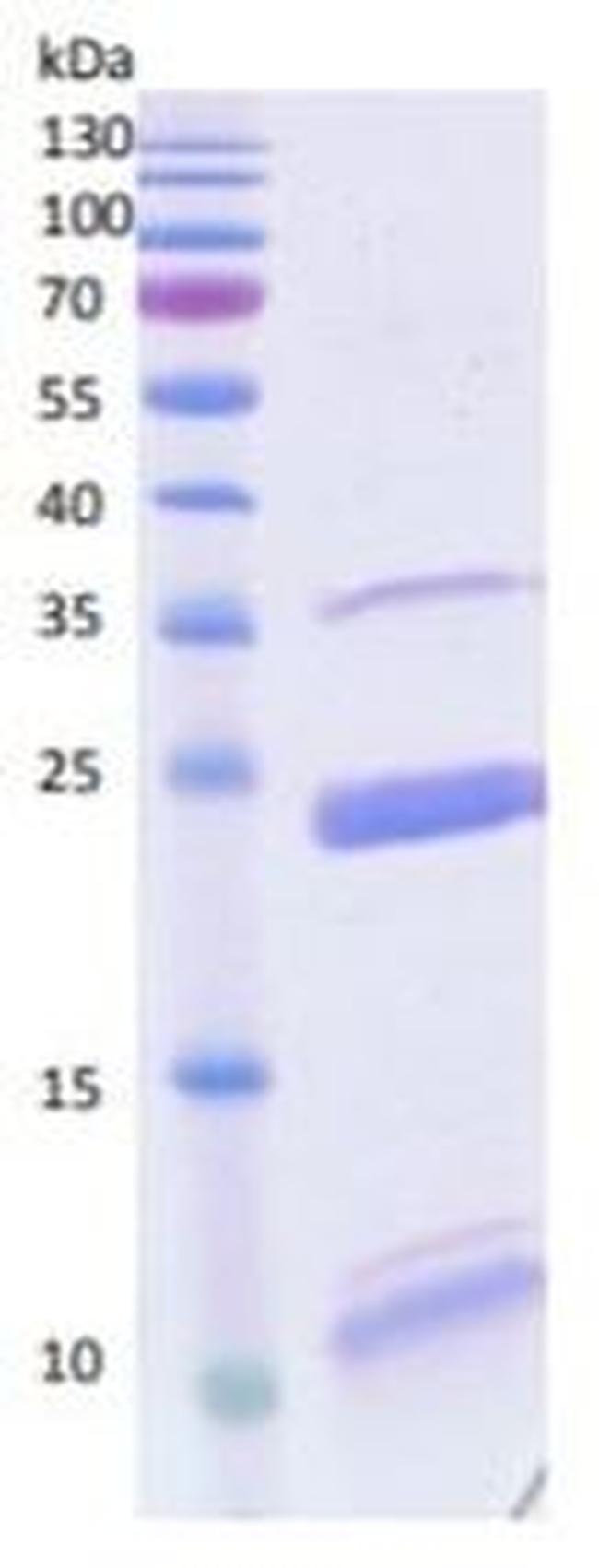 Human MMP17 Protein