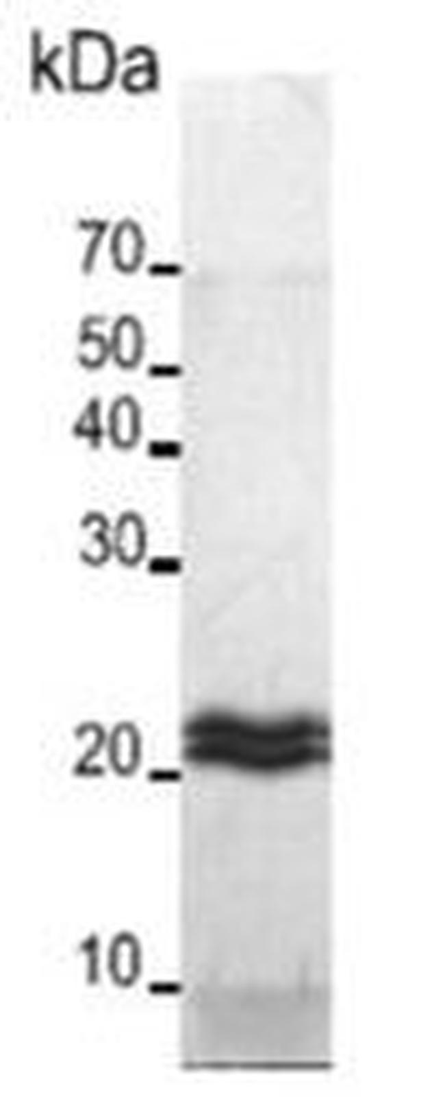 Human MMP-24 Protein