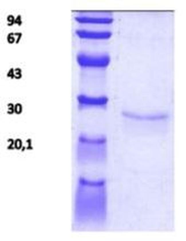 Human TIMP1 Protein
