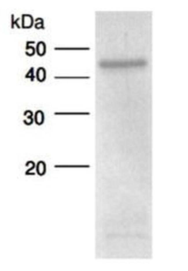 Human ADAMTS4 Protein