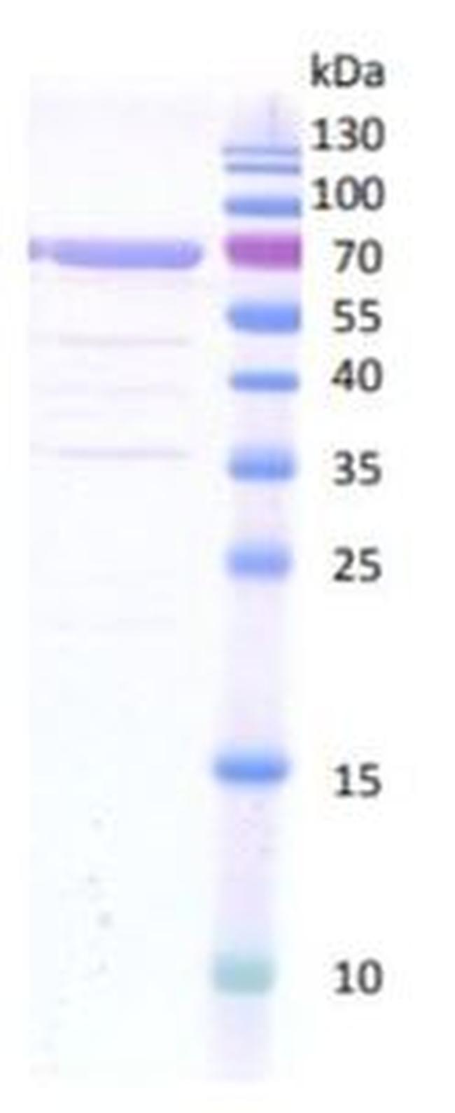 Human MMP-2 Protein
