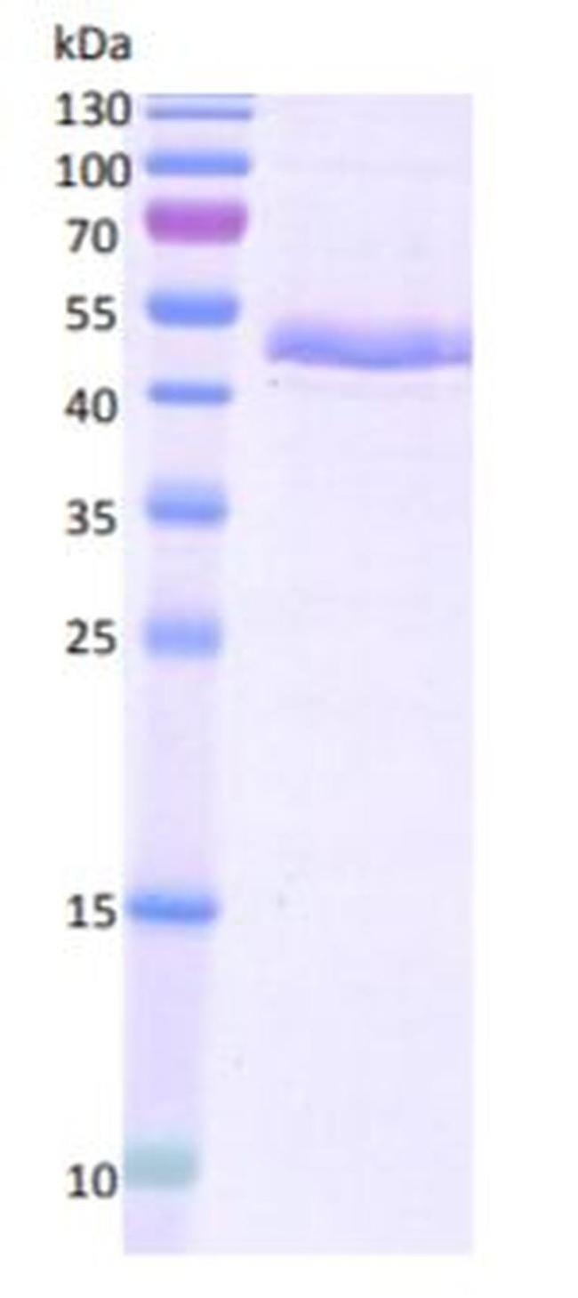 Human ADAMTS1 Protein