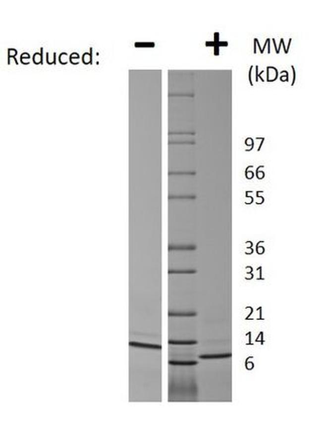 Human CCL13 (MCP-4) Protein