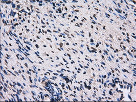 RPA2 Antibody in Immunohistochemistry (Paraffin) (IHC (P))