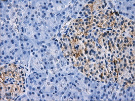 RPA2 Antibody in Immunohistochemistry (Paraffin) (IHC (P))