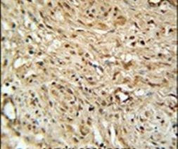 TWISTNB Antibody in Immunohistochemistry (IHC)