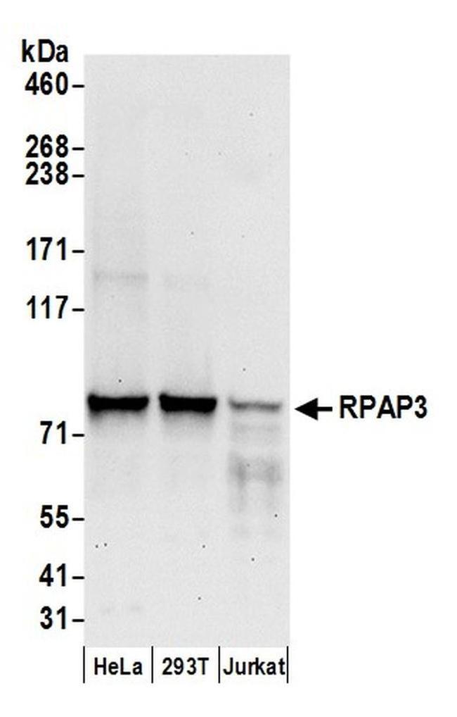 RPAP3 Antibody in Western Blot (WB)