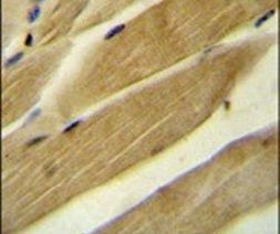 RPH3AL Antibody in Immunohistochemistry (IHC)