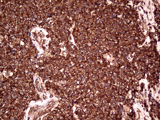 RPL10A Antibody in Immunohistochemistry (Paraffin) (IHC (P))