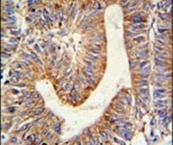 RPL17 Antibody in Immunohistochemistry (IHC)