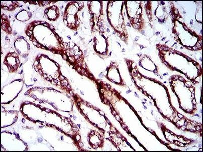 RPL18A Antibody in Immunohistochemistry (Paraffin) (IHC (P))