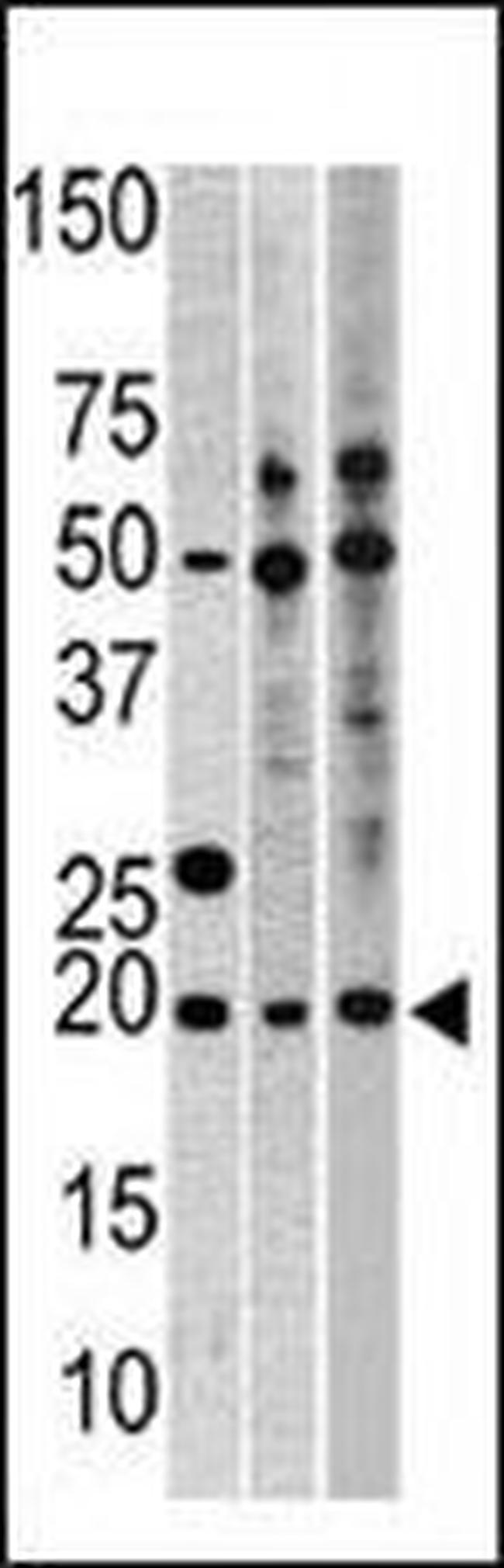 RPL23A Antibody in Western Blot (WB)