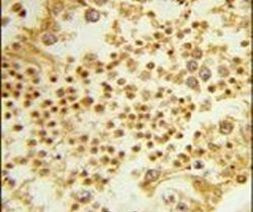 RPL31 Antibody in Immunohistochemistry (IHC)