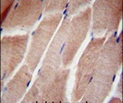 RPL5 Antibody in Immunohistochemistry (IHC)