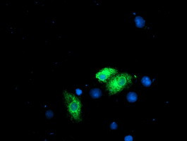 RPN1 Antibody in Immunocytochemistry (ICC/IF)