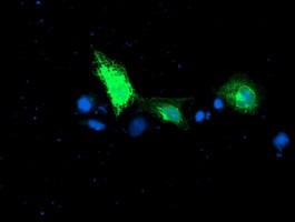 RPN1 Antibody in Immunocytochemistry (ICC/IF)