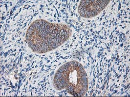 RPN1 Antibody in Immunohistochemistry (Paraffin) (IHC (P))