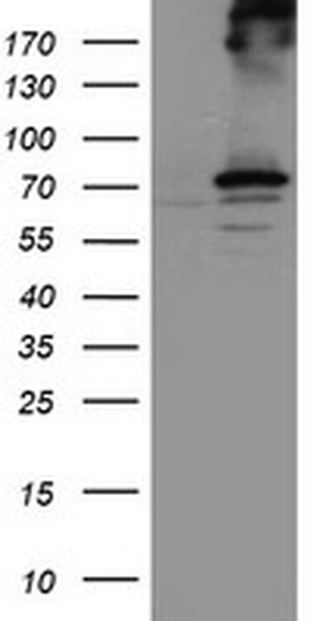 RPN1 Antibody in Western Blot (WB)
