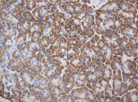 RPN2 Antibody in Immunohistochemistry (Paraffin) (IHC (P))