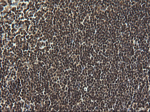 RPRD1B Antibody in Immunohistochemistry (Paraffin) (IHC (P))