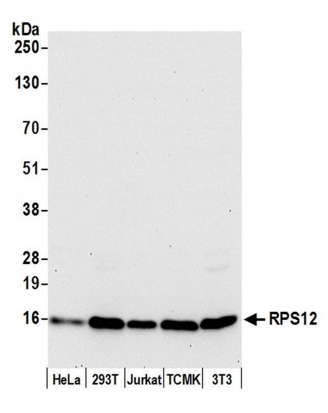 RPS12/Ribosomal Protein S12 Antibody in Western Blot (WB)
