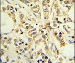 RPS13 Antibody in Immunohistochemistry (IHC)
