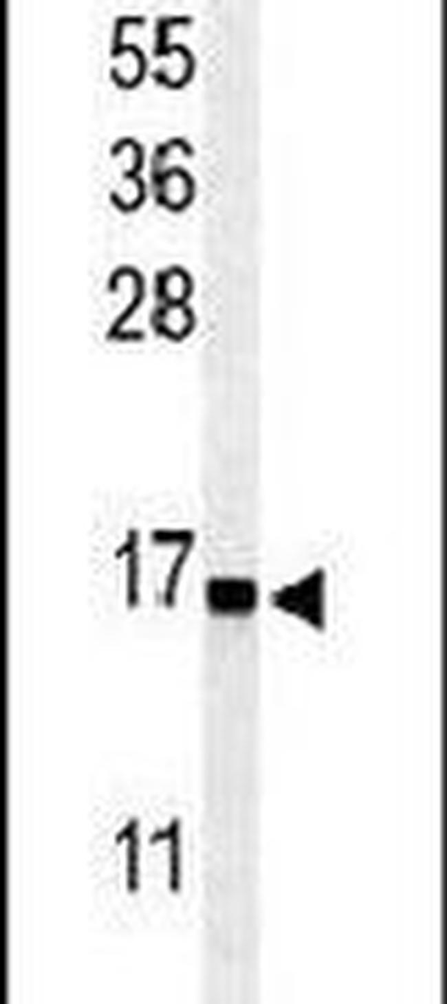 RPS25 Antibody in Western Blot (WB)