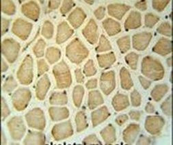 RPS3A Antibody in Immunohistochemistry (IHC)