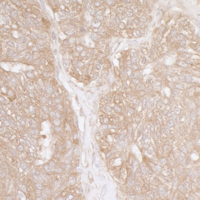Ribosomal Protein S3A/RPS3A Antibody in Immunohistochemistry (IHC)